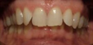 Patient 3 Before
