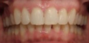 Patient 3 After