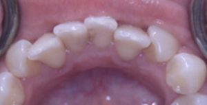 Patient 4 Before