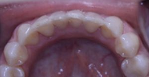Patient 4 After