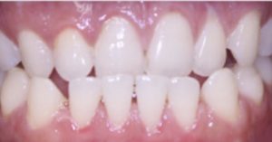 Patient 5 Before