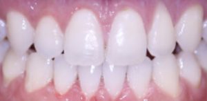 Patient 5 After