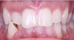Patient 7 Before