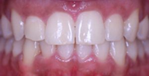 Patient 7 After