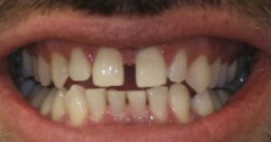 Patient 8 Before