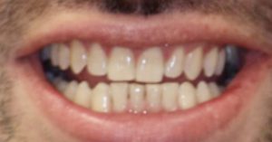 Patient 8 After