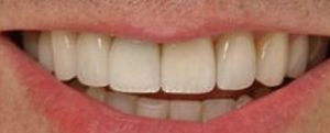 Patient 7 After