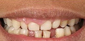 Patient 3 After