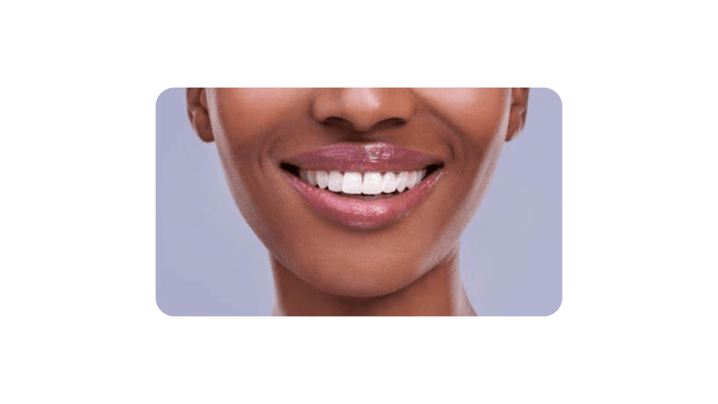 <strong>How To Get That Million Dollar Smile For Less</strong><strong></strong> 1 million dollar smile
