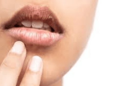 Dark Spots On Lips: 13 Causes And Solutions In Summerlin